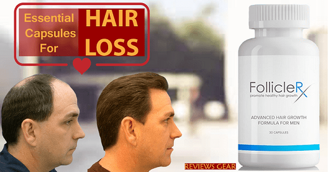 Follicle Rx Hair Growth: Read Review, Benefits and Price - Supplement ...